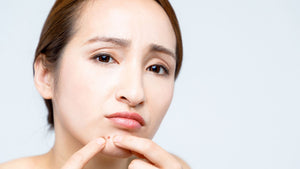 Here's how you can ditch chin acne! Read about the causes and treatment