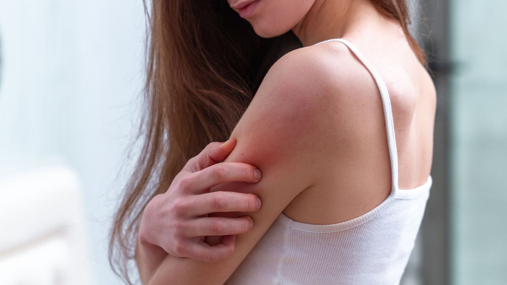 How to Avoid and Treat Heat Rashes in Summers