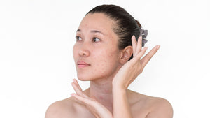 What are Age Spots? How to remove & prevent Age spots?