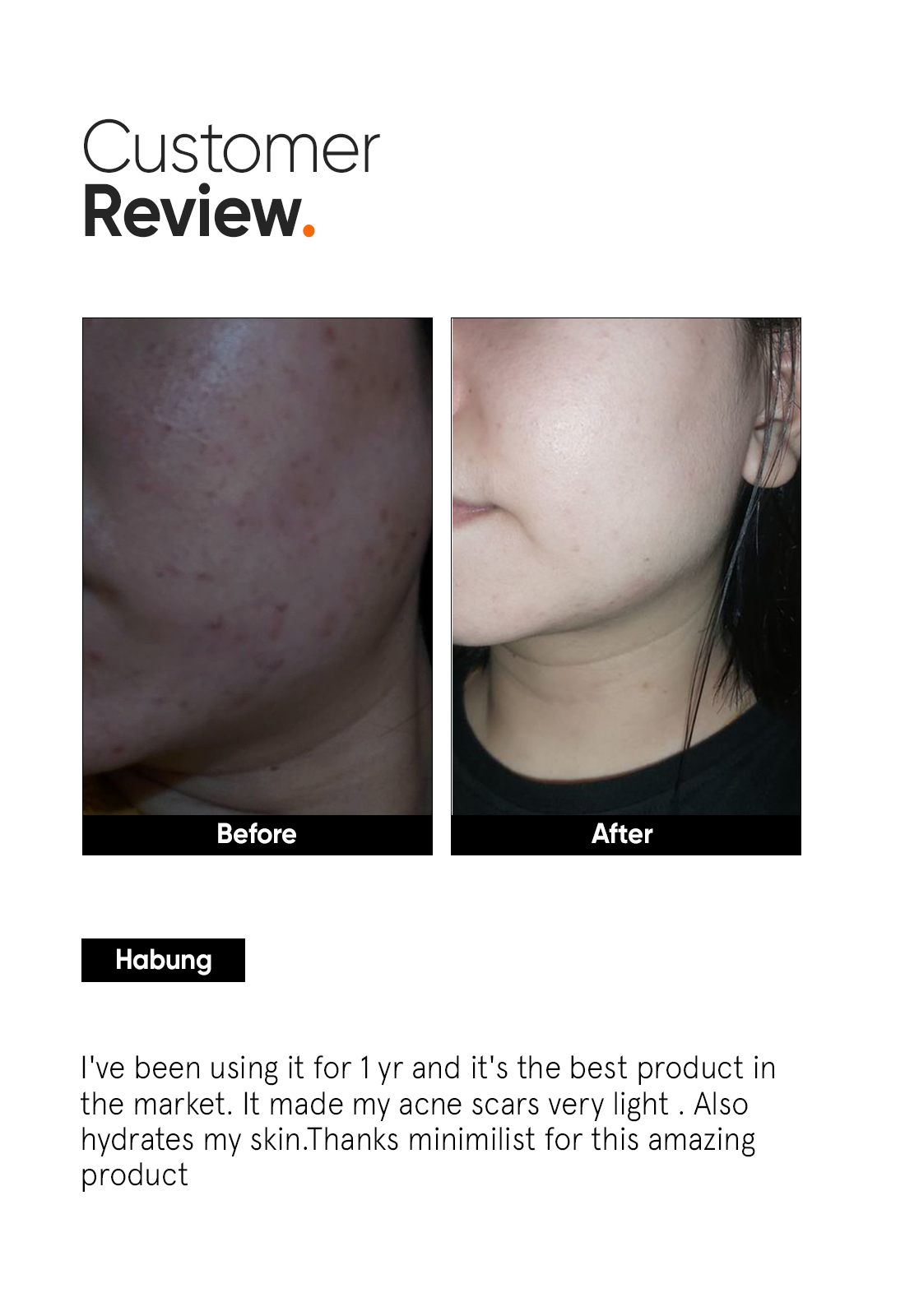 Alpha Arbutin 2% Face Serum - Image 5