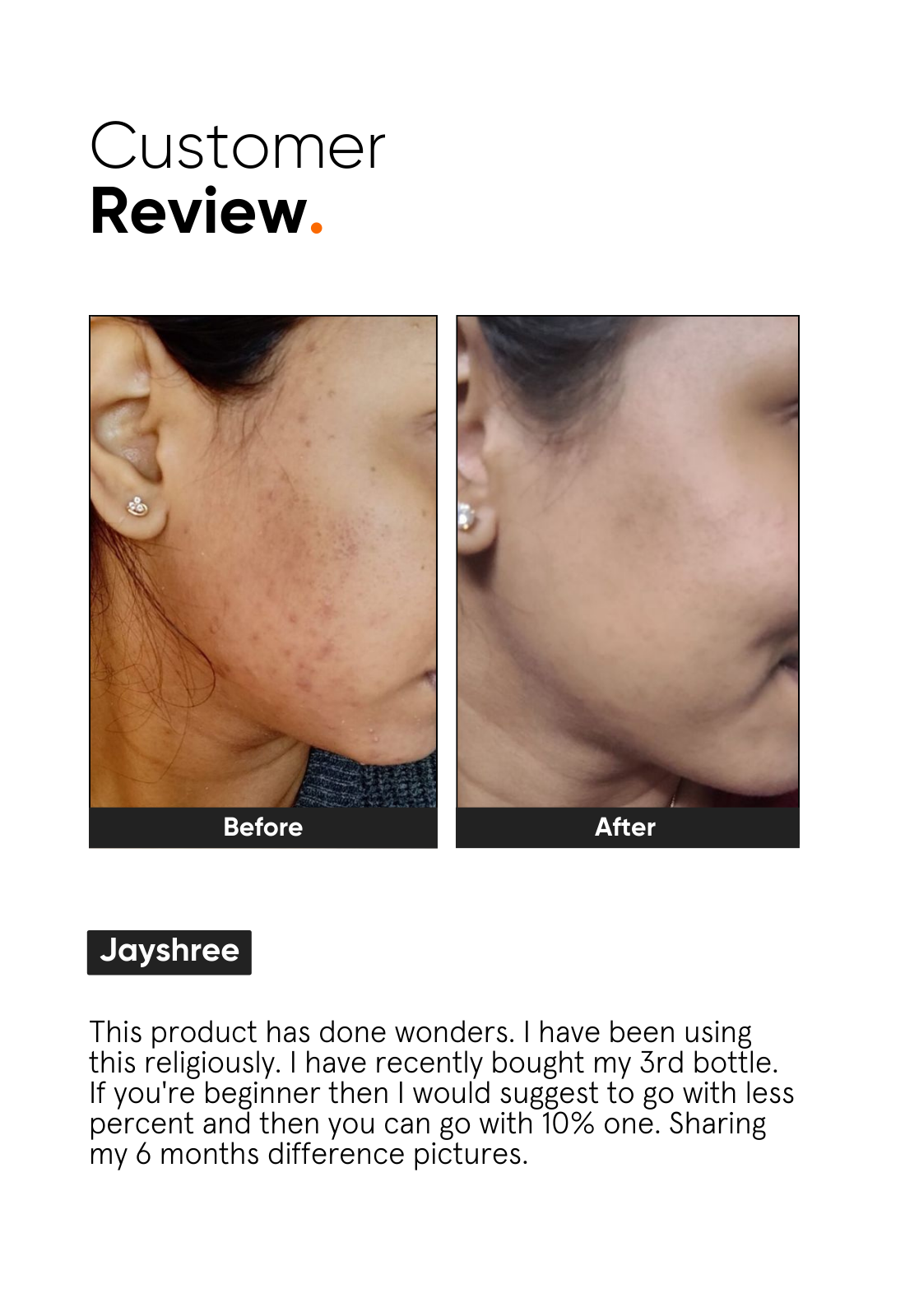 Niacinamide 10% Face Serum - Image 5