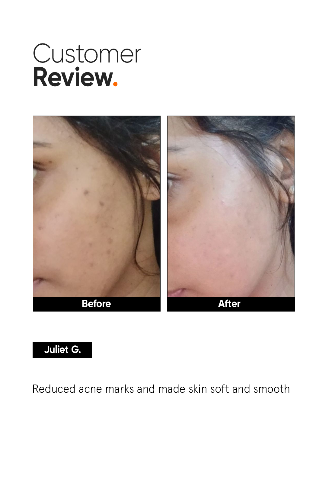 Niacinamide 5% Face Serum - Image 5