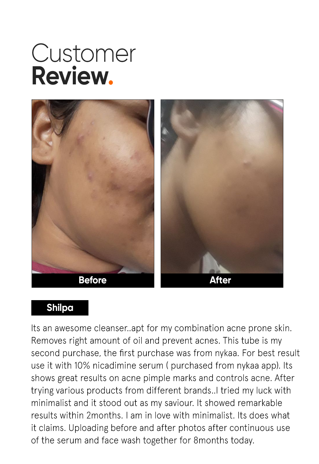 Salicylic Acid + LHA 2% Cleanser - Image 5