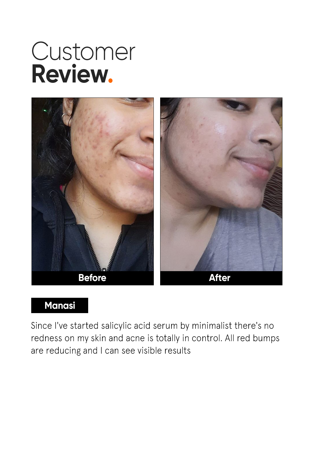 Salicylic Acid 2% Face Serum - Image 5