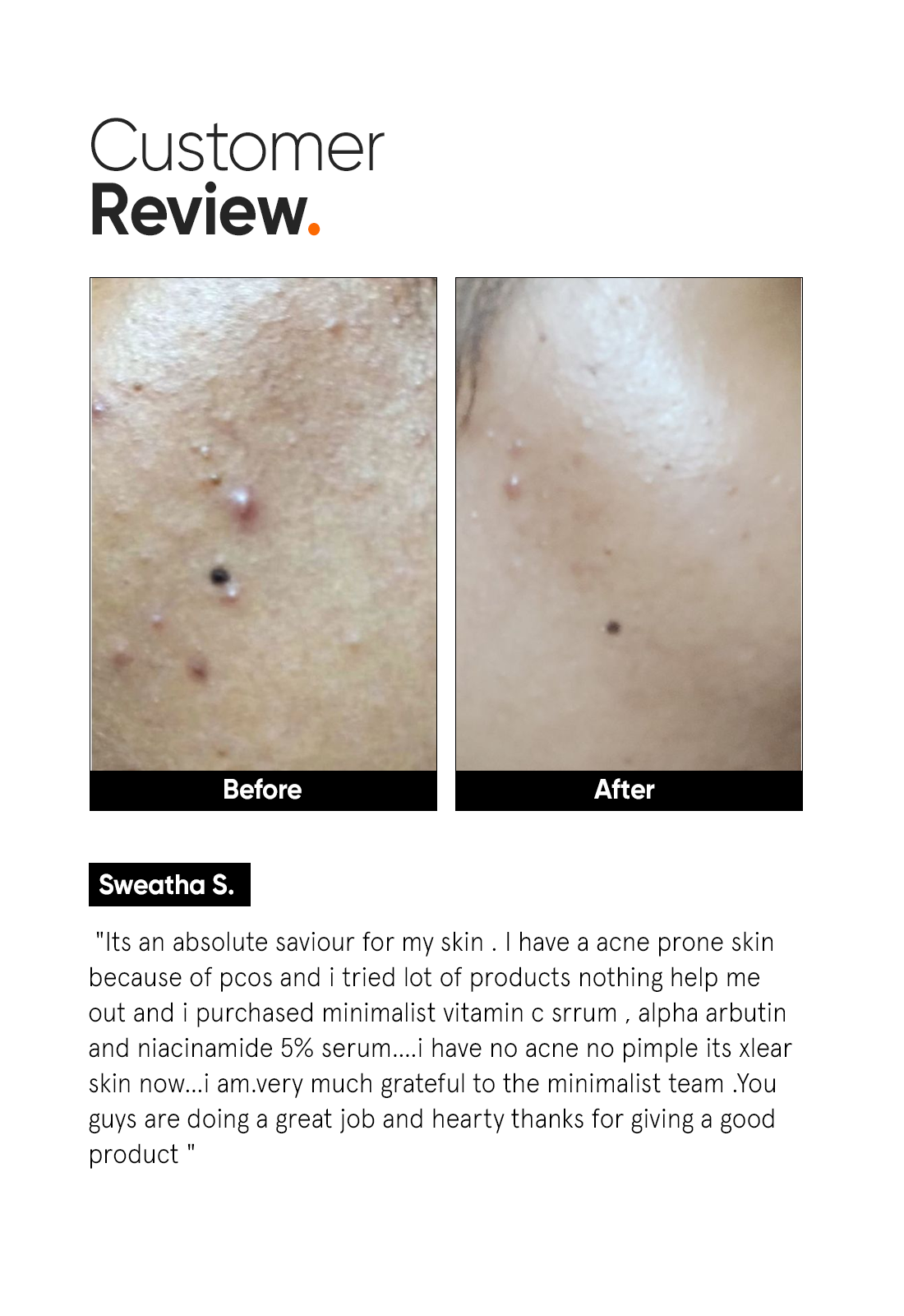 Vitamin C 10% Face Serum - Image 5